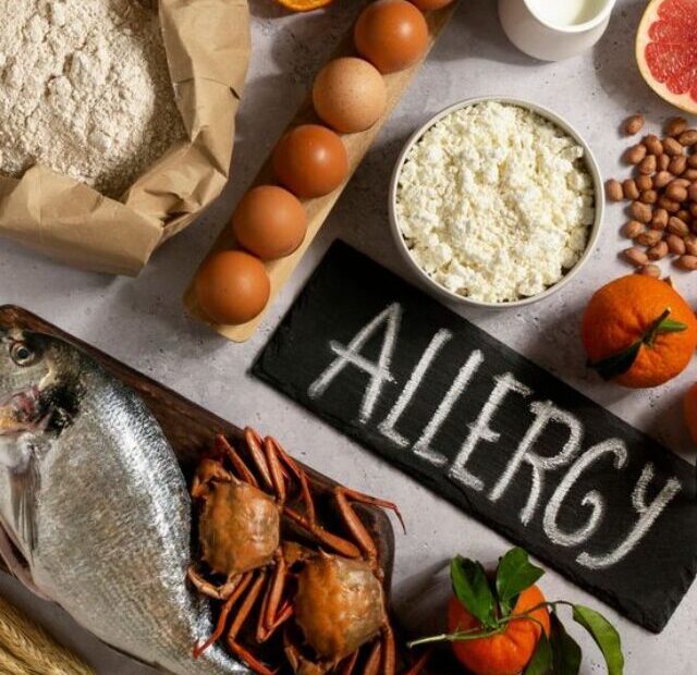 Understanding the Food Allergies_ Common food allergens,simptoms and signs,manage and impact on Dail